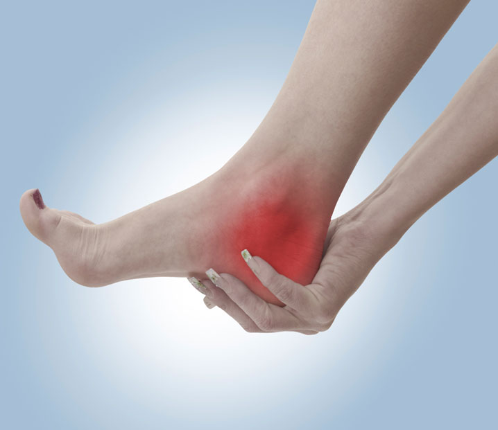 Sacramento Plantar Fasciitis Chiropractors