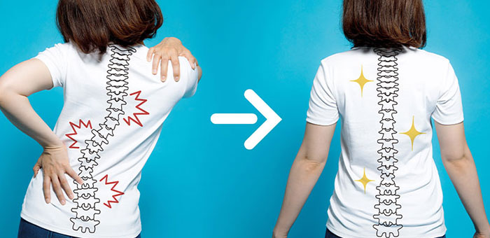 chiropractic for good posture in Sacramento, CA