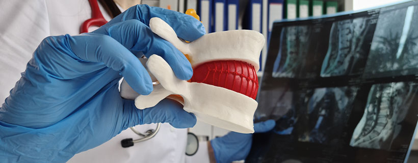 patient needing herniated disc chiropractor in Sacramento, CA